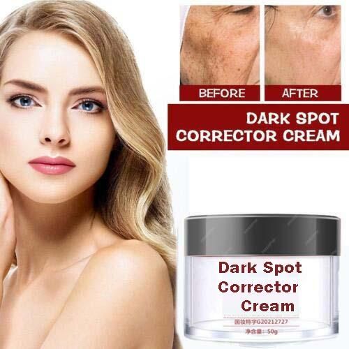 Dark Spot Remover & Skin Brightening Cream – Flawless Glow Formula